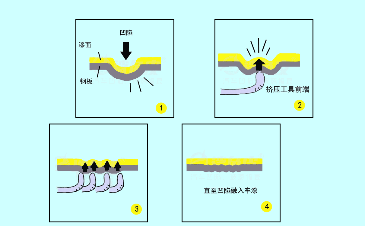 凹陷修复原理